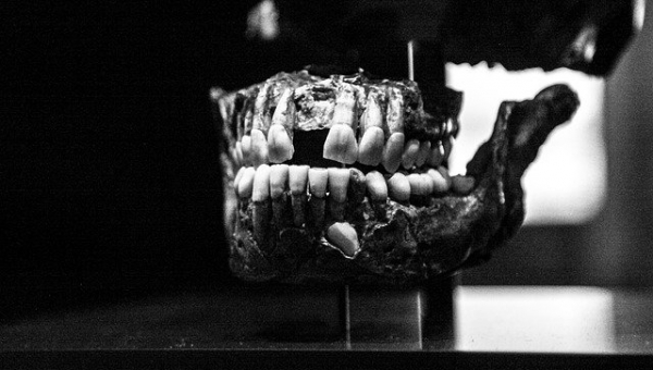 Historias dentales II
