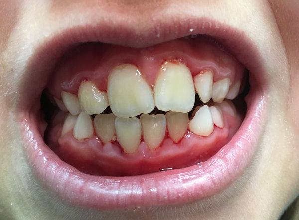 Salud dental II