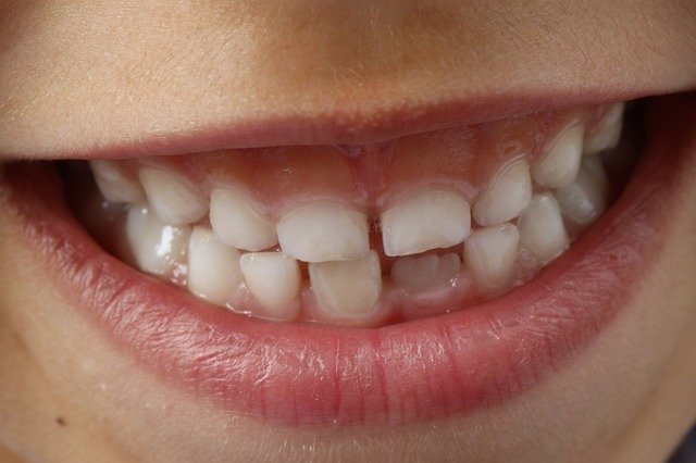 Curiosidades dentales II
