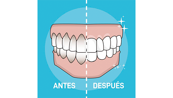 Consultas frecuentes I