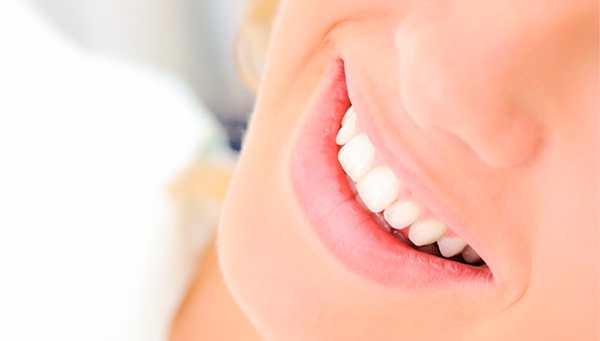Tinción dental