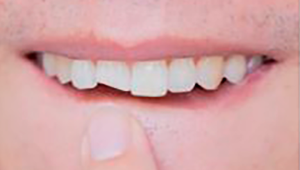 Consejos dentales I