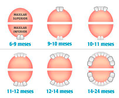 Dentición Infantil