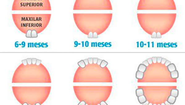 Dentición Infantil