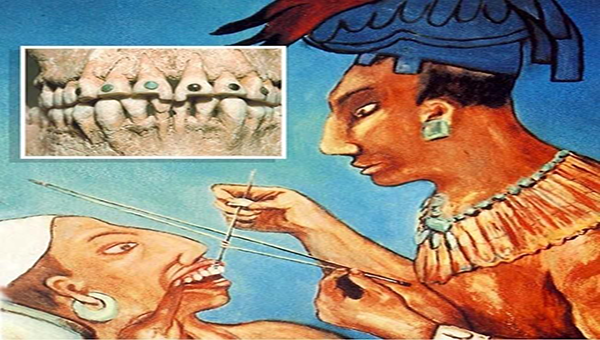 Historias dentales VII