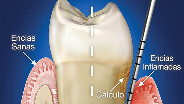 Higiene dental V