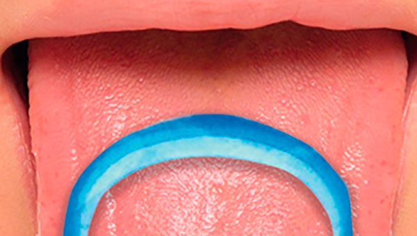 Salud dental IX