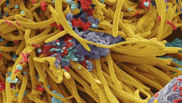 Bacterias