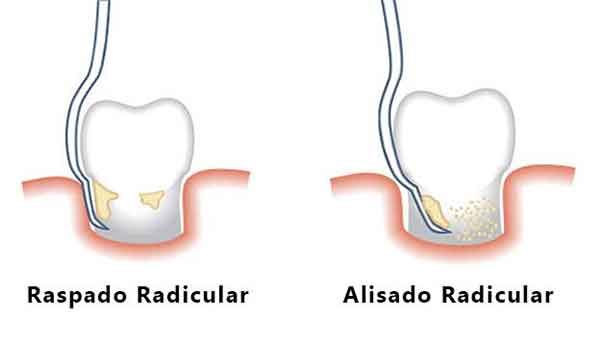 Salud dental XII 