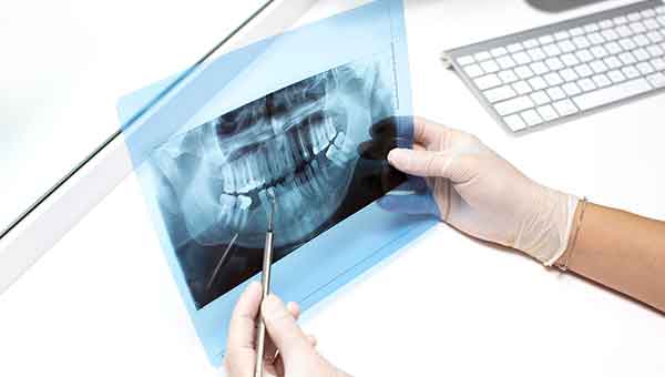 Salud bucodental III