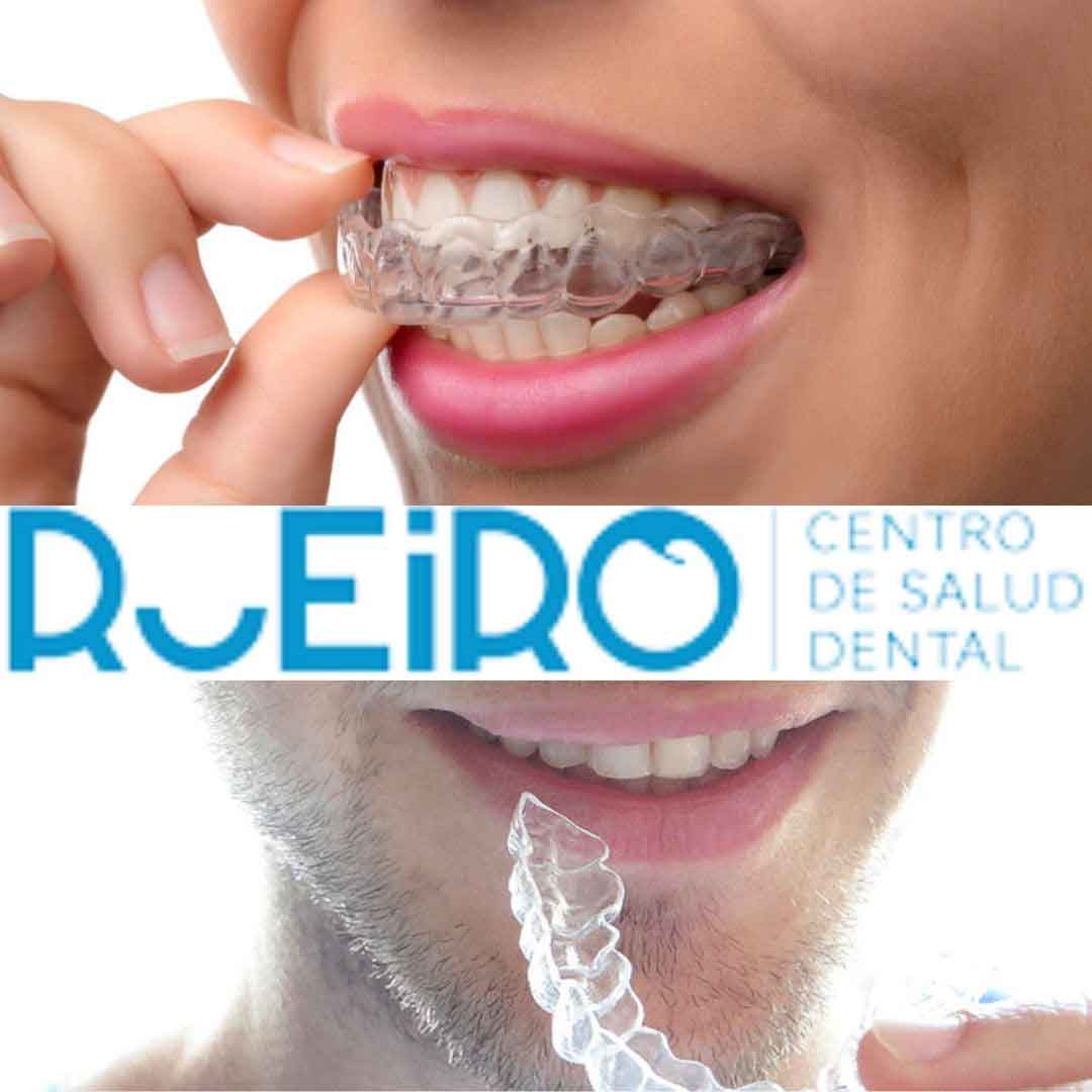 ortodoncia ortodoncia