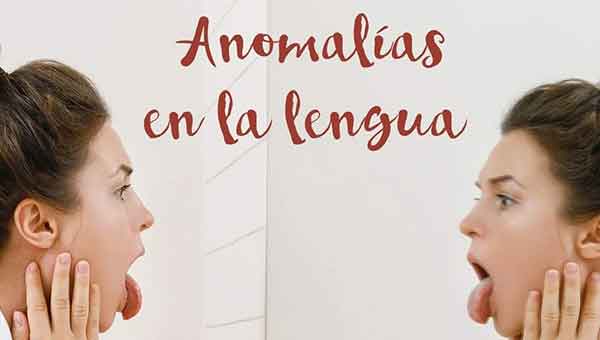 Anomalias dentales