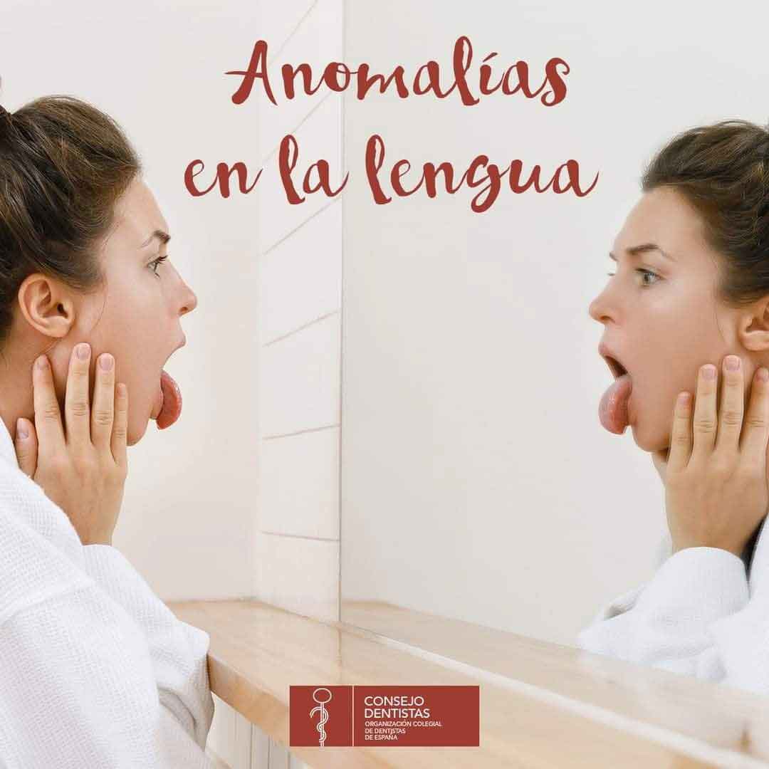 anomalia