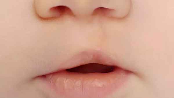 Odontopediatría VII