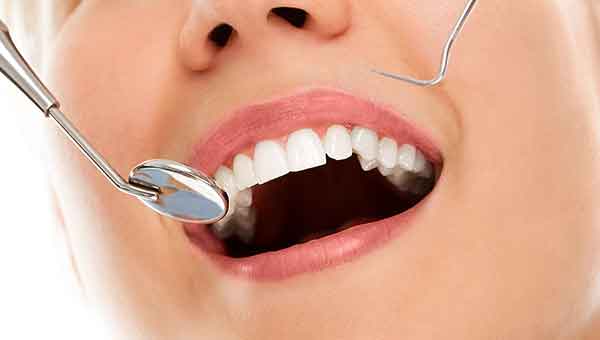 Revisiones dentales I