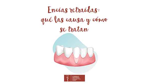 Enfermedades periodontales