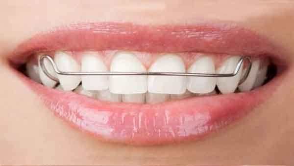 Tu sonrisa II