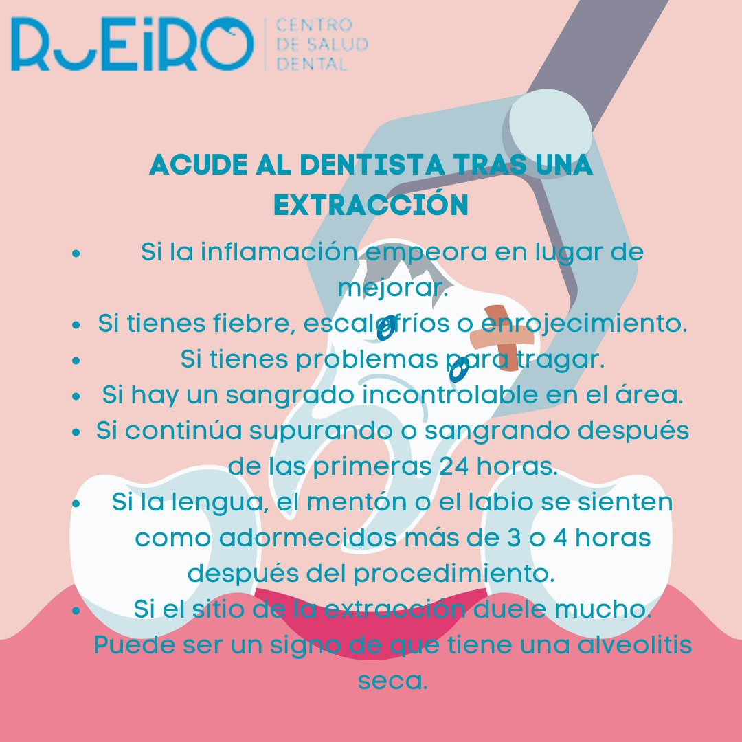 extraccion extraccion