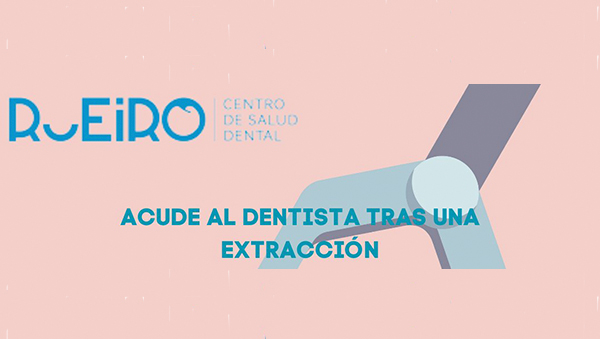 Extracción dental I