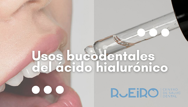 Acido hialurónico I