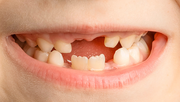 Odontopediatría XVII
