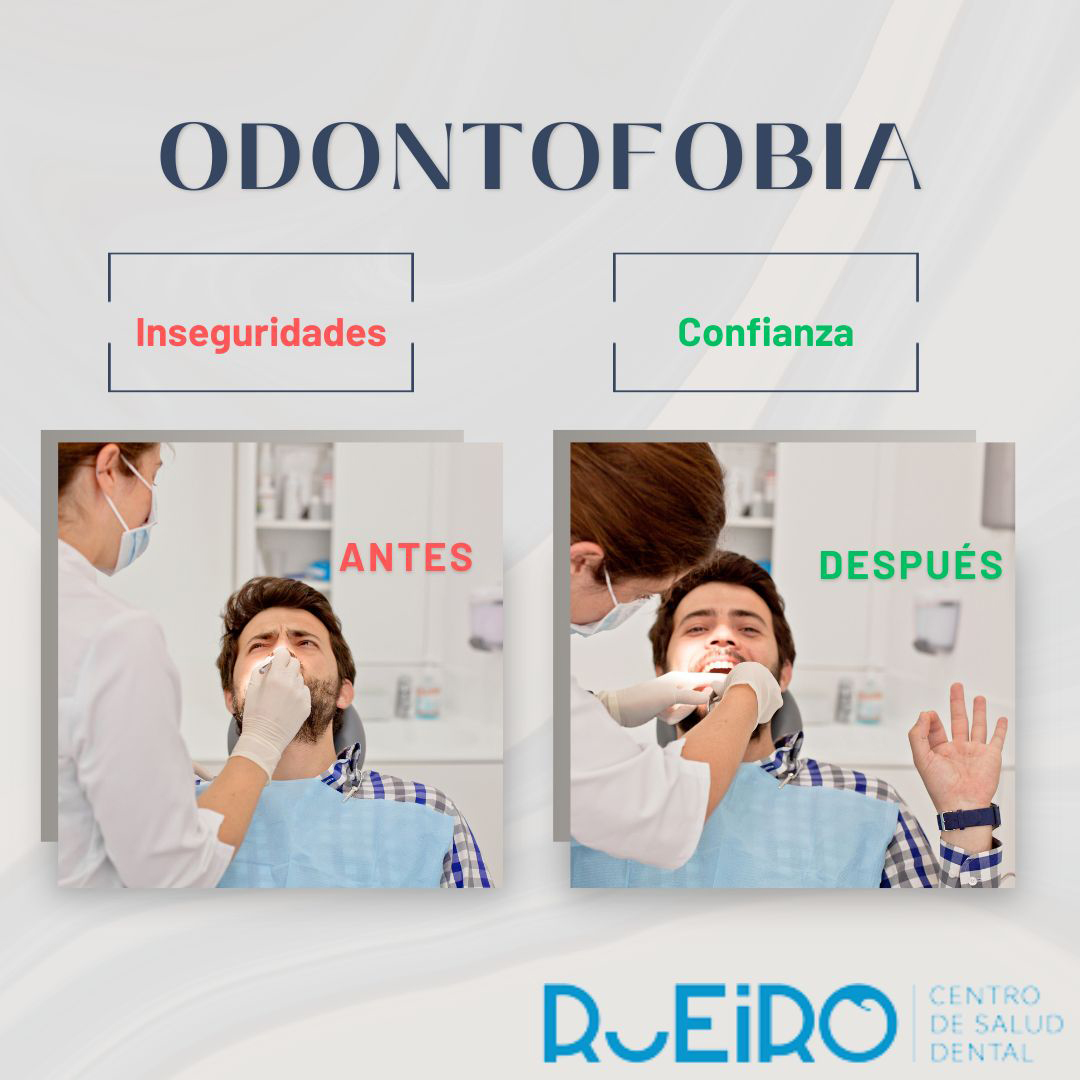 odontofobia odontofobia
