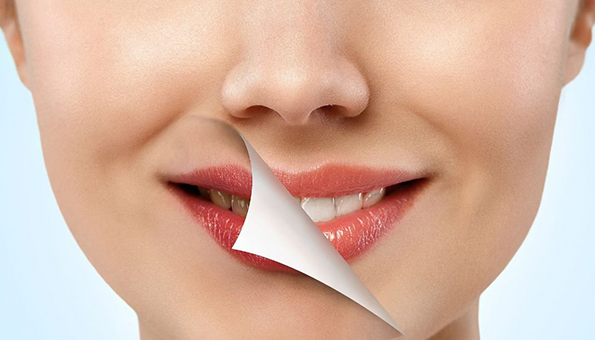 Estética dental V