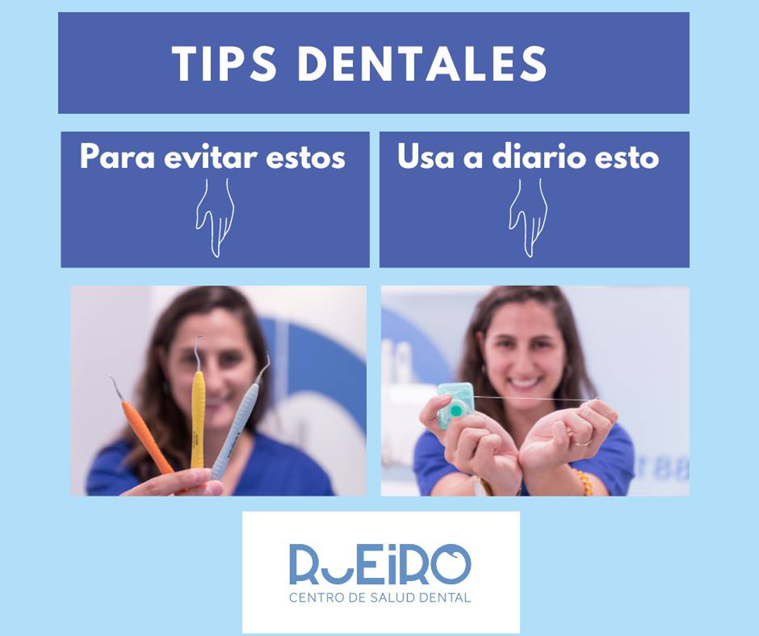 tips